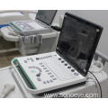 3D Laptop Ultrasound Machine for women with baby